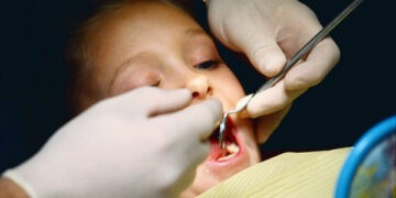 În Moldova asistenţă stomatologică se acordă copiilor la un nivel insuficient, expert