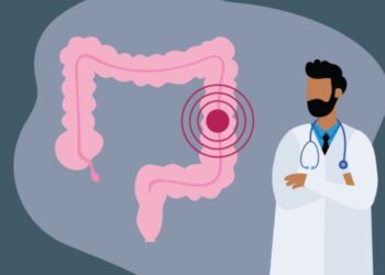 Screening-ul cancerului colorectal va deveni mai accesibil pentru pacienții din Moldova