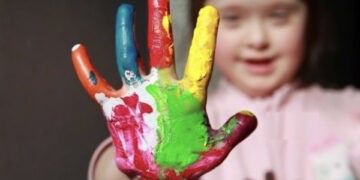 Pe 21 martie este marcată Ziua Mondială a Sindromului Down