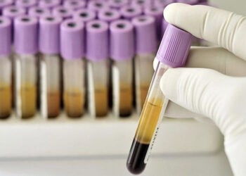 Peste 2800 de cazuri de hepatite virale s-au înregistrat anul trecut